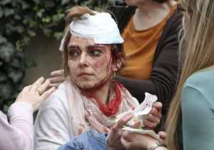 praga injured