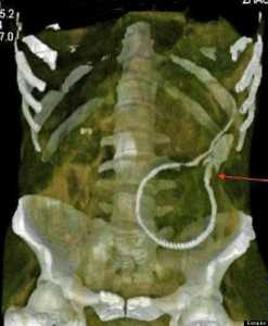 xeli xray