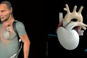 carmat heart