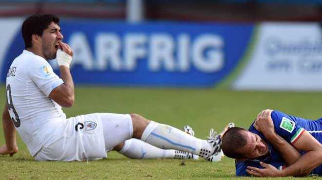 Suarez-bite